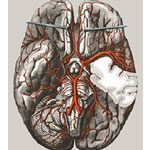 Діаграма стану 3